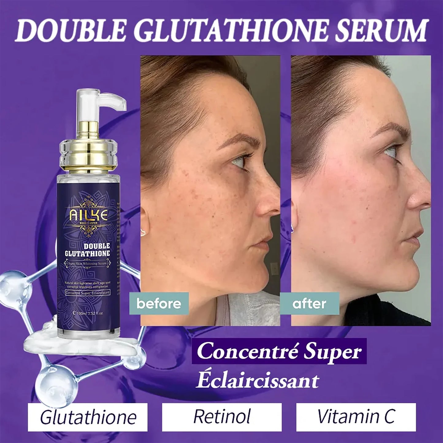 AILKE Double Glutathione Whitening Essence, Moisturizing, Removes Dark Spots, Even Skin Tone Serum For All Skin Types, 100ml