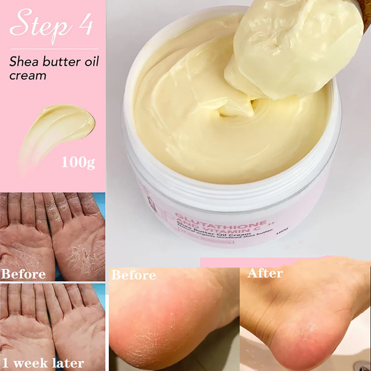 AILKE Whitening And Lightening Cream, For Face and Body, With Shea Butter Oil, Natural Intense Hydrating for Normal to Dry Skin