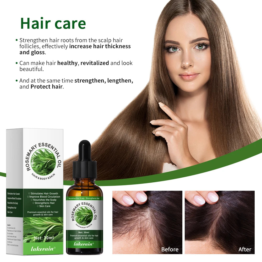 Rosemary Essential Oil 30ml Nourish Scalp Support Hair Health Multi‑Use Oil For Hair Skin Eyelash Massage Shower Body Care Natural Hair Oil
